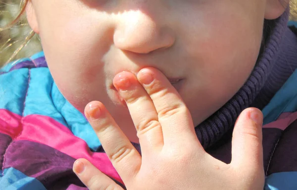 Маленькая Девочка Ест Закрывает Рот Пальцами — стоковое фото