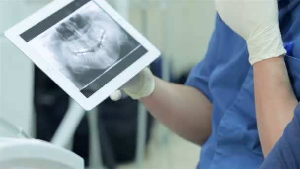 Närbild av en röntgen bild av tänder på tabletten — Stockvideo