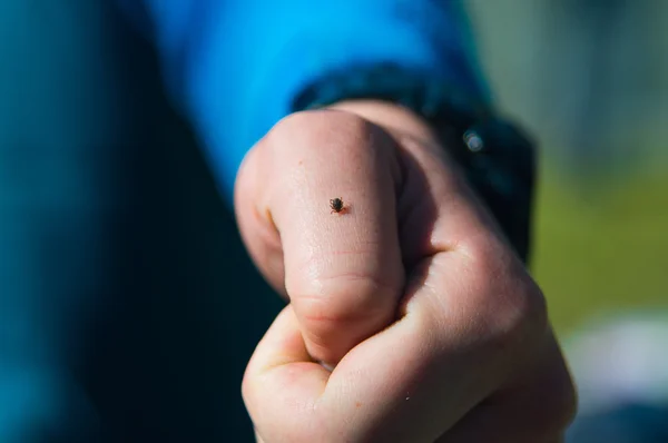 Encefalite por carraças mordidas à mão humana — Fotografia de Stock