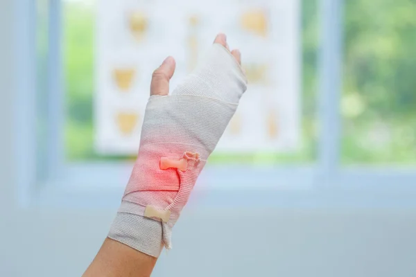 Kötszert Kötni Csuklójára Klinikán Osteophytákban Sarokban Fascia Ortopéd Orvos — Stock Fotó