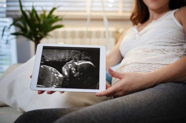 Tablette ultrason inceden inceye gözden geçirmek