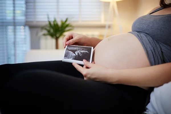 Ultrasound scan on pregnancy belly