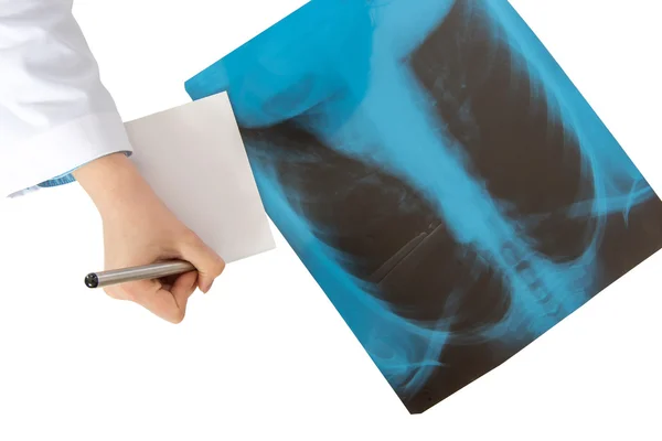 Doktor Röntgen tarama insan akciğer açıklaması yazma