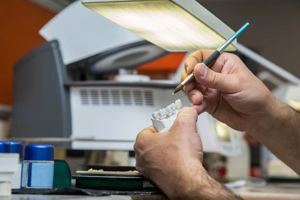 Production dentures — Stock Photo, Image