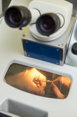 Lazer işleme için Diş Protez