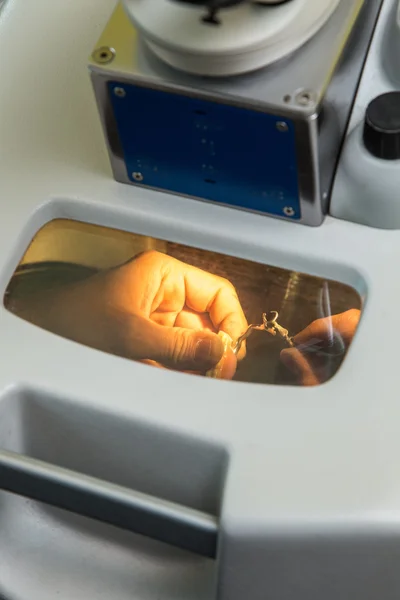 Лазерна обробка зубного протезування — стокове фото