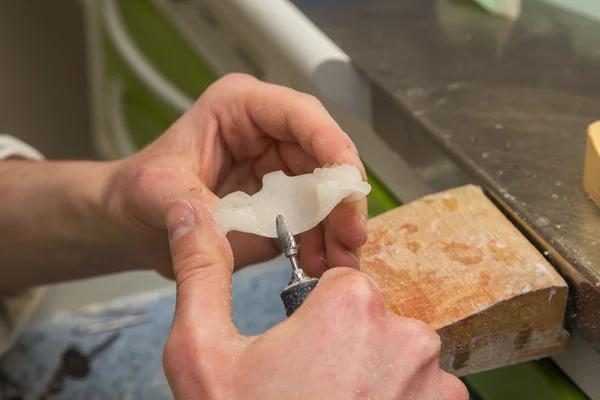 Mecanizado para prótesis dentales Imagen de stock