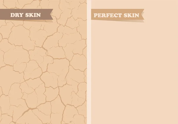 Pele seca, pele perfeita — Vetor de Stock