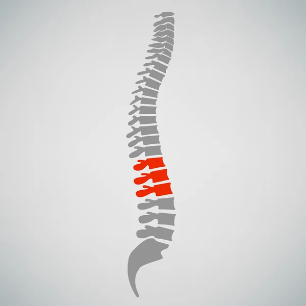 Spine Diagnostics Symbol — Stock Vector