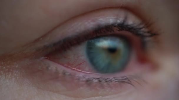 Fille aux yeux rouges secs irrités ou allergique. Femme souffrant de rougeur. Conjonctivite, kératite — Video