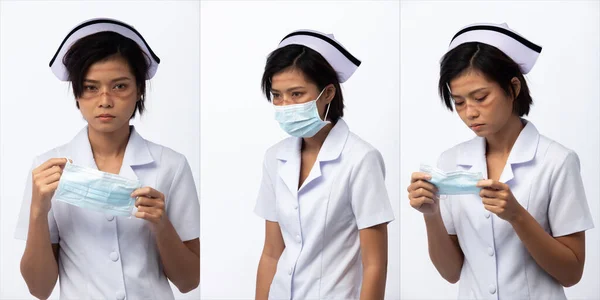 Infirmière Enlever Masque Protecteur Visage Après Travail Trouvé Marque Blessure — Photo