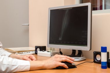 Roentgenographer dijital görüntülerin arşiv tarama