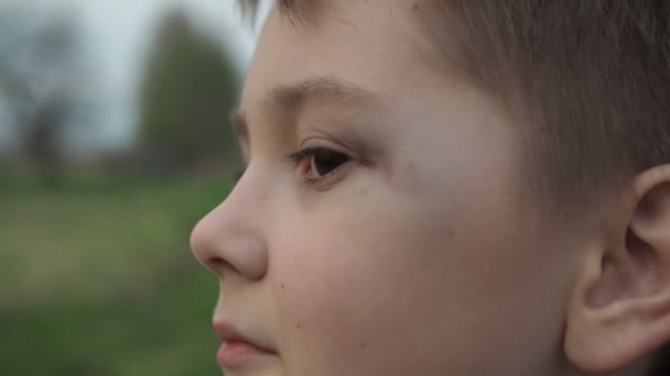 Een brutale jongen met een blauw oog. De nasleep van het gevecht. aan het eind trekt hij een gezicht — Stockvideo