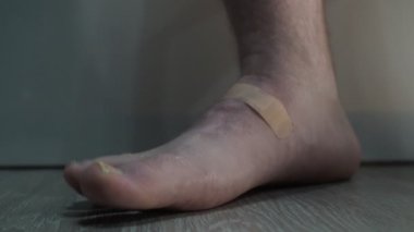 Bir adam kıllı bacağındaki yaradan yara bandını çıkarır.