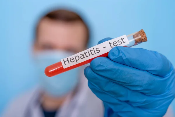 Tangan Sarung Tangan Medis Memegang Botol Darah Untuk Tes Hepatitis — Stok Foto