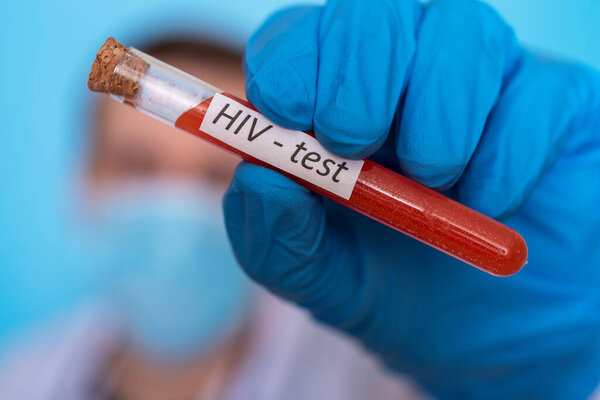 A test tube with blood for an HIV test is held by a doctor's hand in medical gloves. The concept of research and development for disease control.