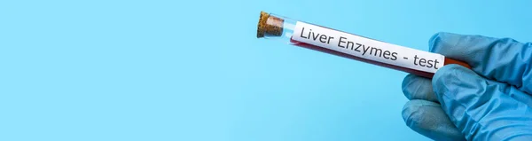 Hand Holding Liver Enzyme Test Vitro Blue Background Conceito Medicina — Fotografia de Stock