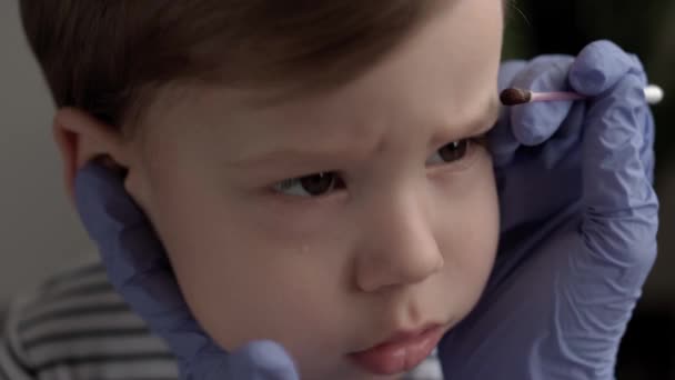 Zblízka lékař dermatolog v modrých rukavicích skvrny jód skvrny tvář 3-4 let malý kluk předškolní. Nad ramenem ošetřovatelka léčí akné u dítěte. medicína a zdraví, koncepce pediatrie — Stock video