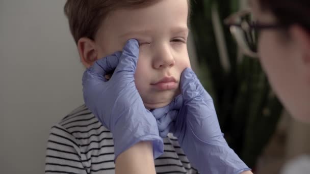 Zblízka žena lékař dermatolog v modrých rukavicích vyšetřuje tvář 3-4 roky menší školka chlapce. Nad ramenem ošetřovatelka léčí akné u dítěte. medicína a zdraví, pediatrie, koncept covid-19 — Stock video
