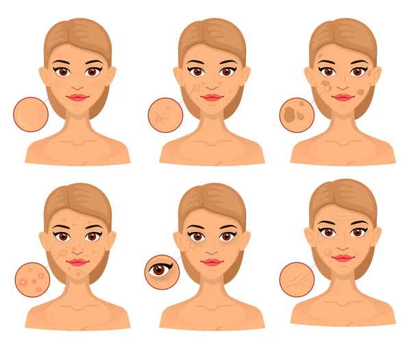 Seth woman different types of problem skin, enlarged area for cosmetology. Acne, wrinkles and age spots. — Stock Vector