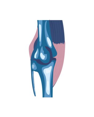 Romatoloji eklem kemiği