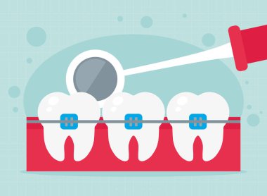 Diş Aynası Çizimi