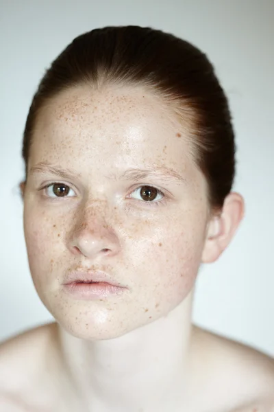 Girl With Freckles — Stock Photo, Image