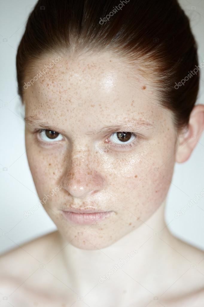 Girl With Freckles