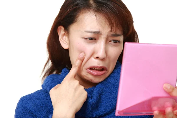Mulher asiática se preocupa com a pele seca áspera — Fotografia de Stock