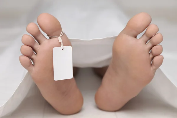 Dead body at a morgue — Stock Photo, Image