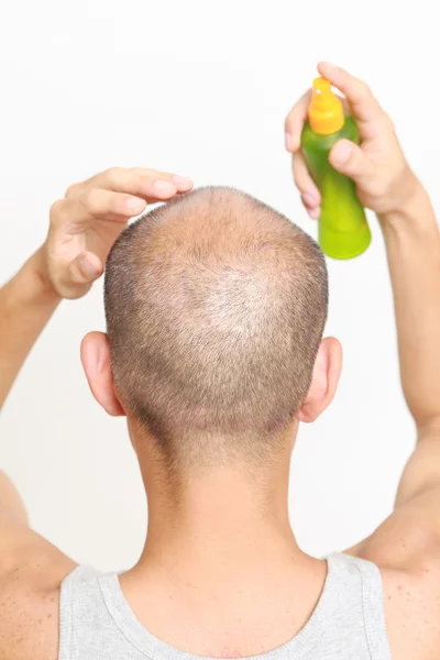 Pemulihan rambut — Stok Foto