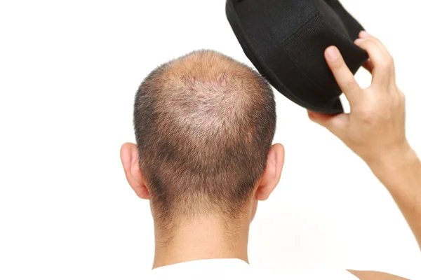 Bald man with a hat — Stock Photo, Image