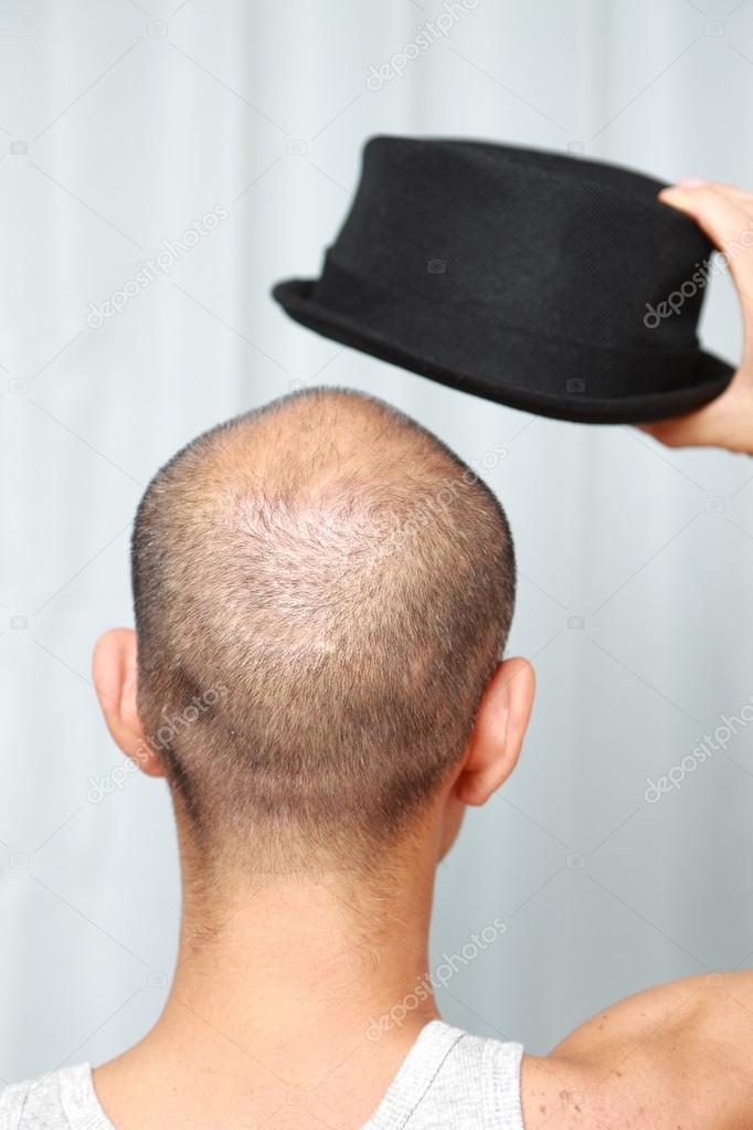 Bald man with a hat
