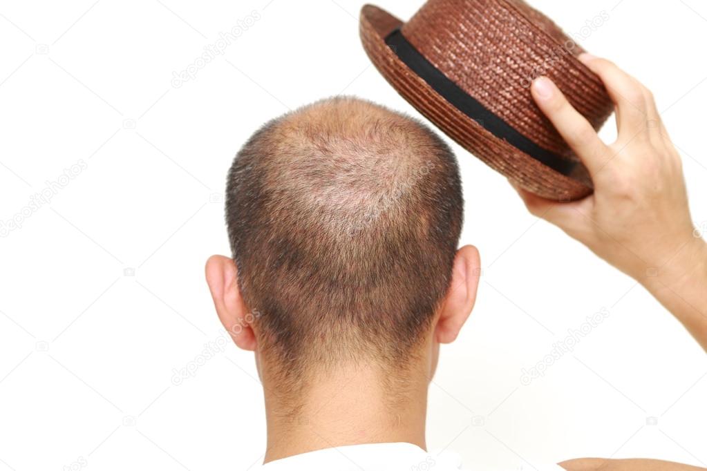 Bald man with a hat