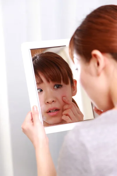 Young Japanese woman worries about dry rough skin — Stock Photo, Image