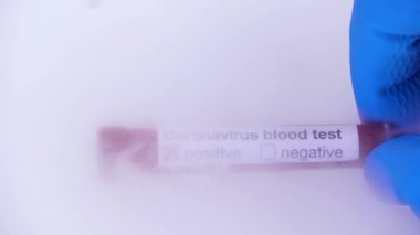 Coronavirus salgını ve kan testi konsepti tıp laboratuarında. Test tüpü ve COVID-19 sonucu pozitif. Kuru buz dolu bir tıbbi buzdolabından test çıkarıyorum.