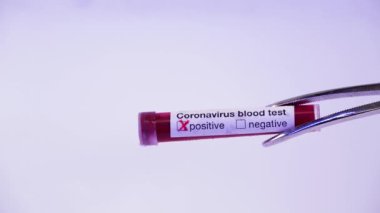 Coronavirus salgını ve kan testi konsepti tıp laboratuarında. Test tüpü ve COVID-19 sonucu pozitif. Kuru buz dolu bir tıbbi buzdolabına test yaptırmak.