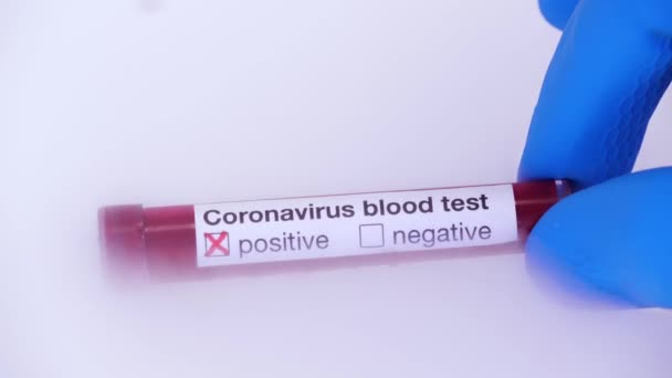 科罗纳韦病毒在医学实验室中的爆发和血液检测概念 Covid 19阳性结果 在装有干冰的医用冰箱上进行测试 — 图库视频影像
