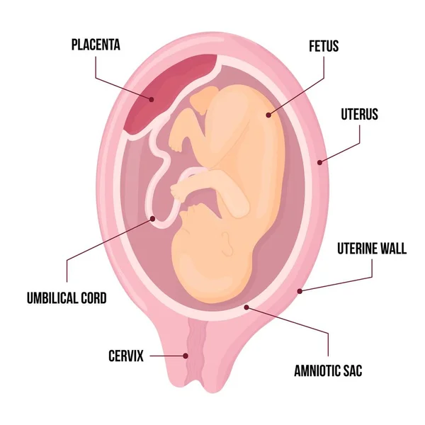 Vektor infographic med foster av livmoder och moderkaka. anatomi diagram illustration med navelsträng och livmoderhals. — Stock vektor