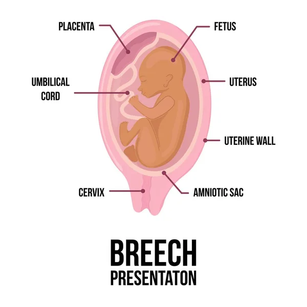 Bébé Peau Brune Arabie Latine Différentes Mauvaises Positions Bébé Dans Graphismes Vectoriels