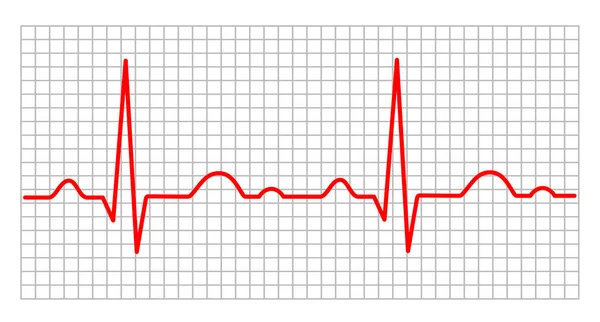 Grafica Elettrocardiogramma Qualità Vettoriale — Vettoriale Stock