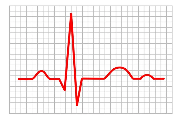 Electrocardiogram Graphic Vector Quality — Stock Vector