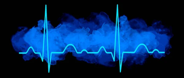 Grafica Elettrocardiogramma Qualità Vettoriale — Vettoriale Stock