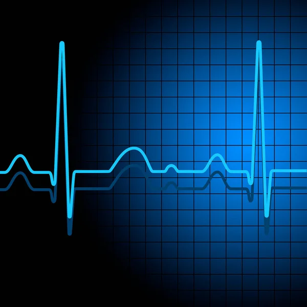 ベクトル品質の心電図とグラフィック — ストックベクタ