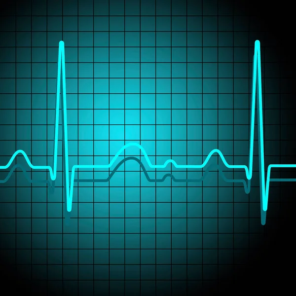 Grafico Con Elettrocardiogramma Qualità Vettoriale — Vettoriale Stock