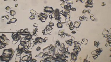 Kedi idrar mikroskobik değerlendirilmesi