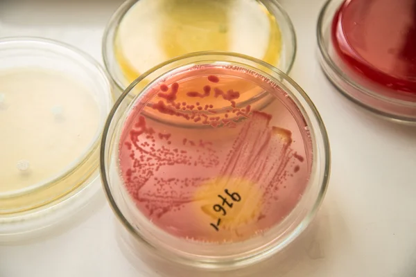 Petri kabına bakteri kolonisi. Telifsiz Stok Fotoğraflar