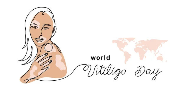 Världen vitiligo dag vektor banner, affisch, bakgrund. Kvinna med fläckig hud. En kontinuerlig linje konst ritning med bokstäver vitiligo dag — Stock vektor