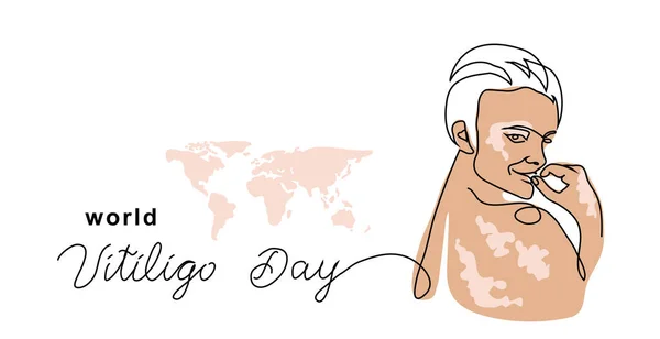Vitiligo hud enkel vektor banner, affisch, bakgrund. Person med hudpigmentering. En kontinuerlig linje konst ritning och bokstäver världen vitiligo dag — Stock vektor