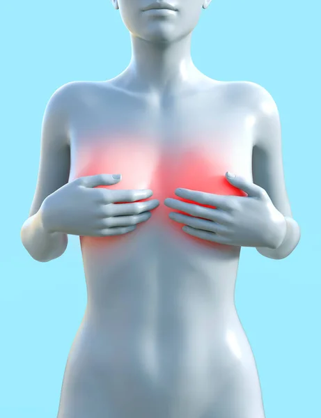 Визуализация Женской Фигуры Подсветкой Груди Красным Светом Раком Молочной Железы — стоковое фото